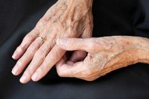 Osteoporosis Joint Pain