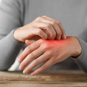 Natural Remedies for Candida Overgrowth | Rose Wellness