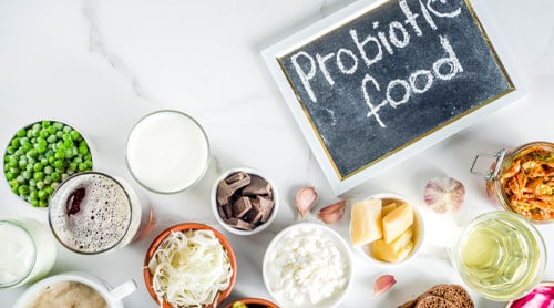 probiotic and fermented foods